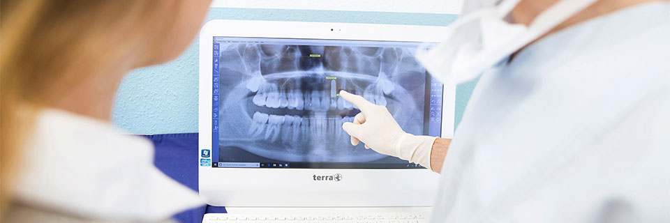 Fragen zu Zahnimplantaten